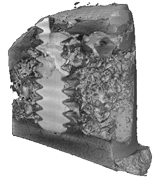 Uncertainties in models for Mg-based implant materials